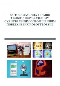 Обкладинка для Фотодинамічна терапія з вибірковим лазерним сканувальним опроміненням поверхневих новоутво