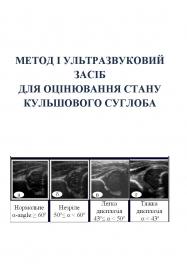 Обкладинка для МЕТОД І УЛЬТРАЗВУКОВИЙ ЗАСІБ ДЛЯ ОЦІНЮВАННЯ  СТАНУ КУЛЬШОВОГО СУГЛОБА